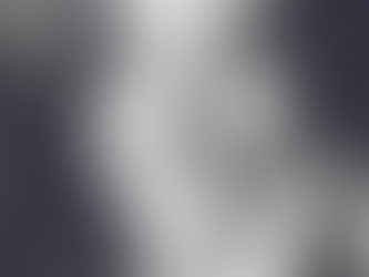 3 Things You Should Know About Facial Fillers