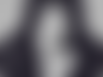 Lip Augmentation: A Natural Appeal