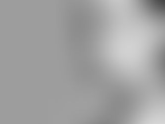 Lost Volume in the Lips or Under the Eyes? Fill Them In!