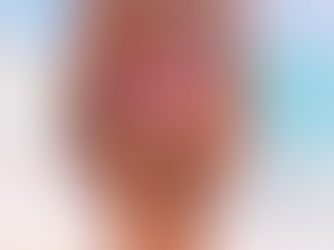 What Can I Expect After My Brazilian Butt Lift?