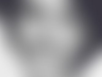 Voluma®, Volbella®, & Vollure™ – Oh My!