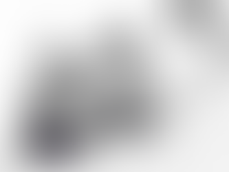 Four Things that We Learned About diVa™ from Dr. Karlinsky-Bellini on Facebook Live