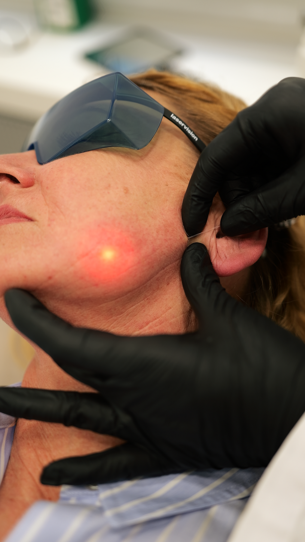 Laser Kosten Düsseldorf Olga Ludewig