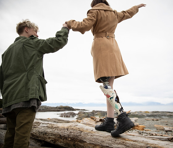 Man with Amputee Girlfriend on Beach