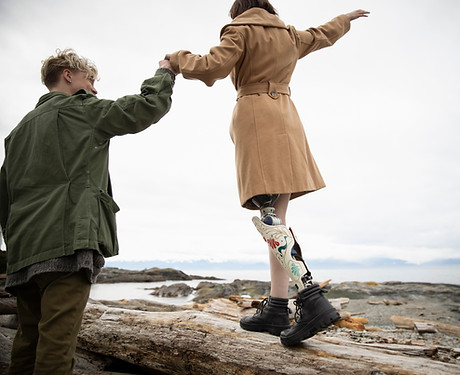 Man with Amputee Girlfriend on Beach