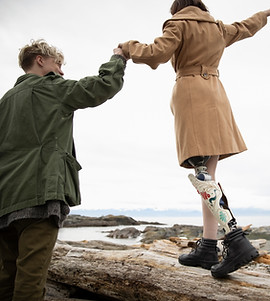 Man with Amputee Girlfriend on Beach