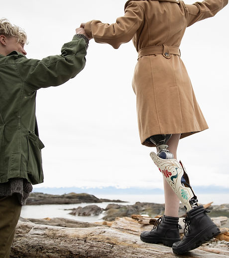 Handicap et mouvement, soutien d'un homme à sa femme amputée