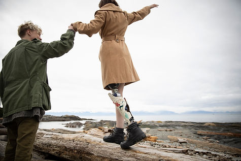 Man with Amputee Girlfriend on Beach