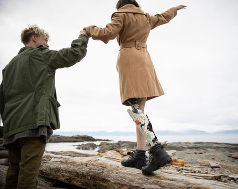 Man with Amputee Girlfriend on Beach