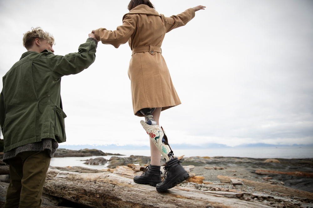 LEG AMPUTATION A BEFORE AND AFTER GUIDE
