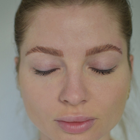 Prodigy Peel by iS Clinical