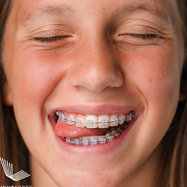 Teen Girl Purple Ties 1