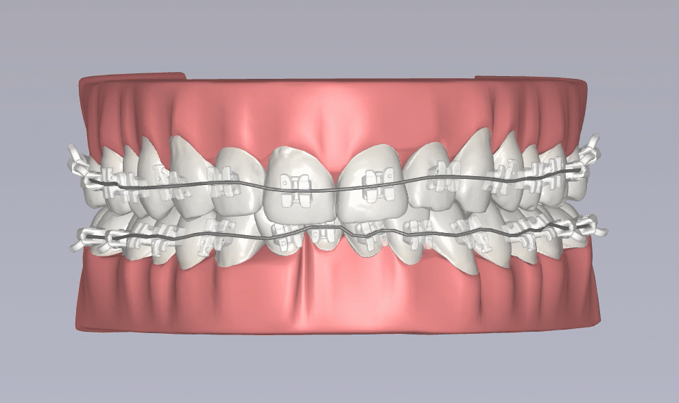 LightForce_LightPlan