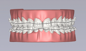 LightForce_LightPlan