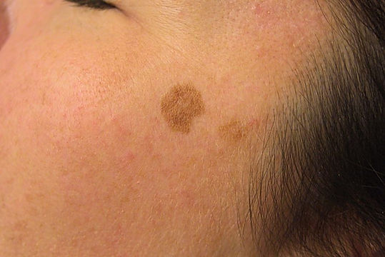 Sun Spots