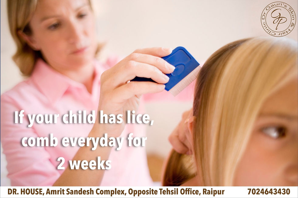 Head Lice - Dr Gauri Patil Raipur