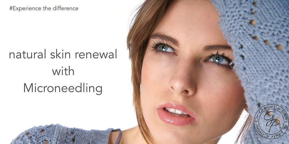 Microneedling