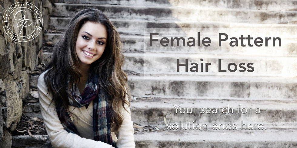Female Pattern Hair Loss