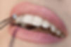 Dentist doctor select a gem or rhinestone for the patient’s teeth, Mouth close up.jpg