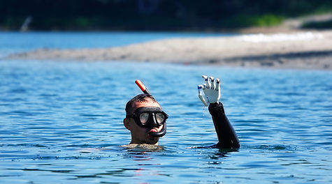 Eine Person schwimmt im See mit Schnorchelmaske; eine bionische Handprothese ragt aus dem Wasser, während sie den Arm hebt