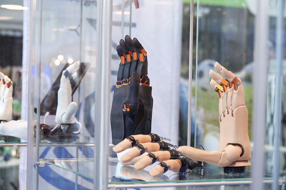 Teilhand- und Fingerprothesen in unterschiedlichen Ausführungen werden gemeinsam in einer Glasvitrine ausgestellt