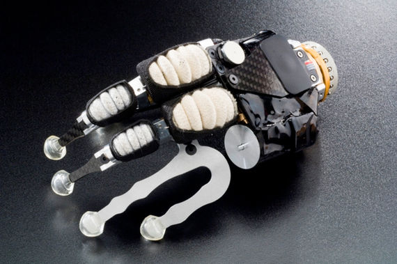 erste hydraulische Handprothese