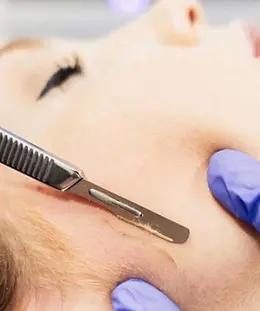 dermaplaning.jpg.webp