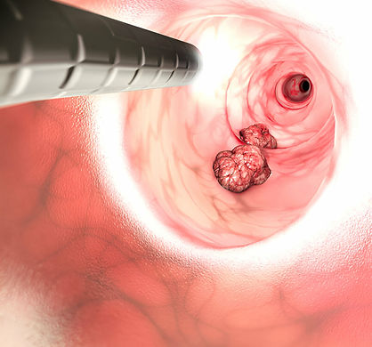 Photo d'une fibroscopie