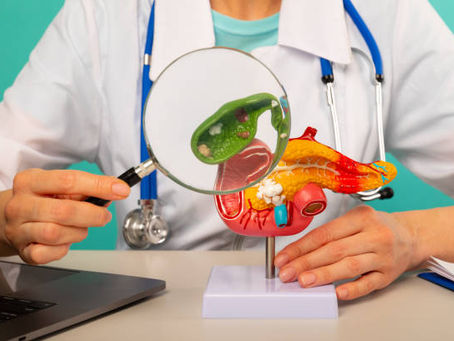 Que son las piedras en la vesícula o colelitiasis: Todo lo que necesitas saber para tomar la mejor decisión