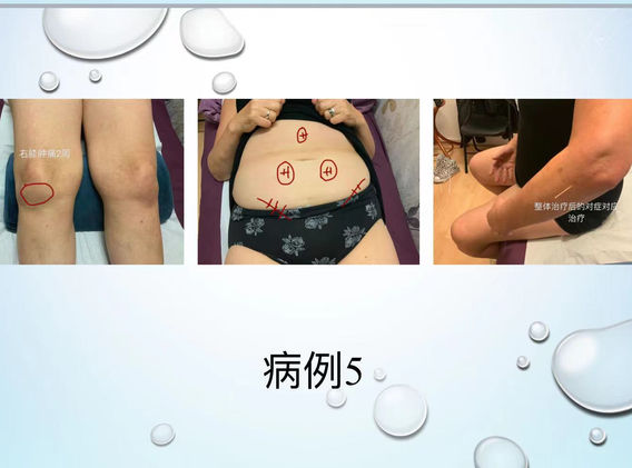 Wang Ying’s abdominal diagnosis lecture 21.jpeg