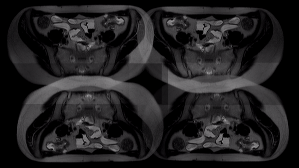 flare 1 (1).png