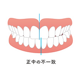 清田区 インプラント