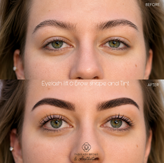 eyelash lift