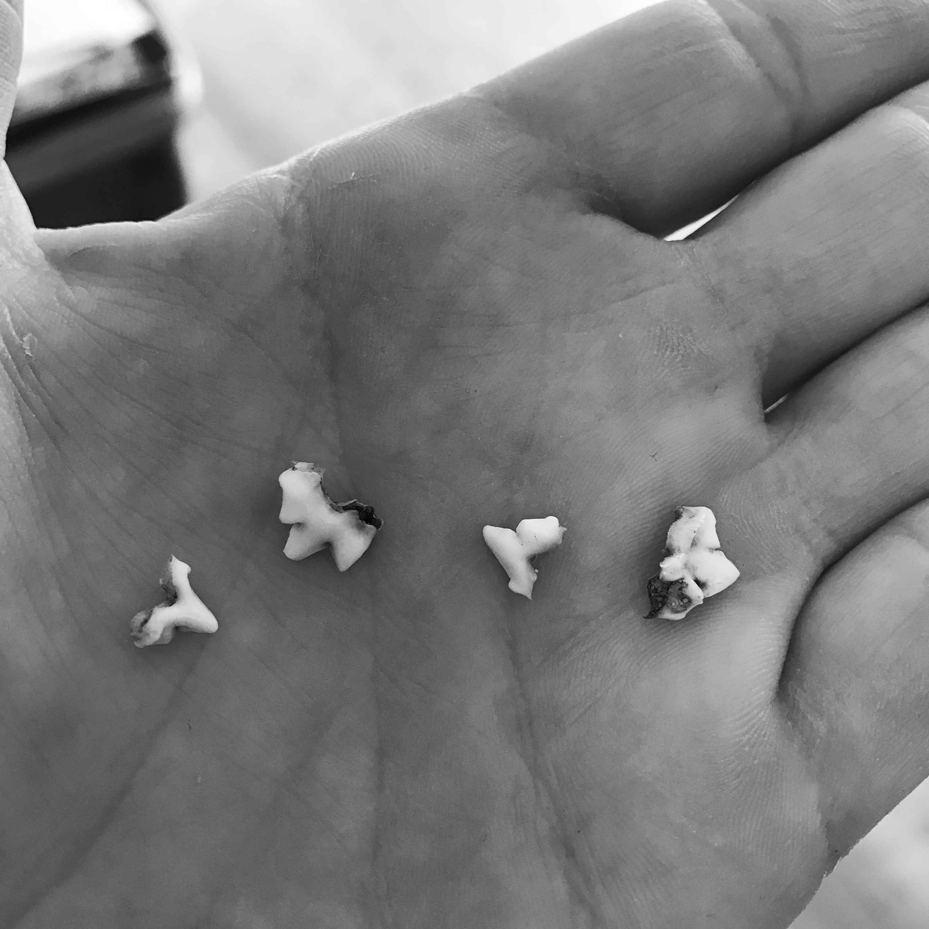 Baby teeth