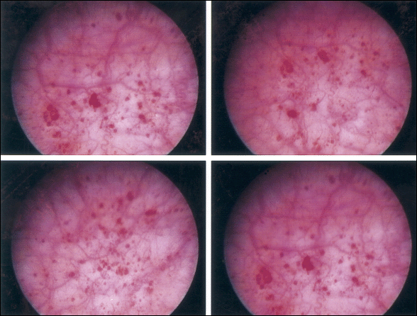 glomerulations.gif