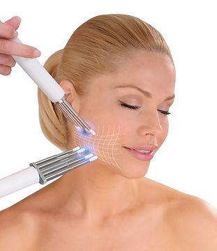 CACI-JOWL.jpeg