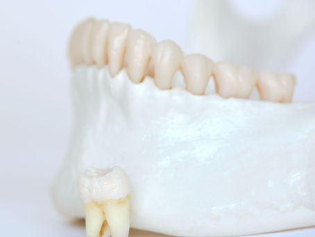 Third Time's a Charm: What are Wisdom Teeth Anyway?