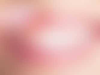 Why Are My Gums Black? What Causes Changes in Gum Color