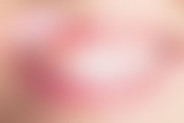 Why Are My Gums Black? What Causes Changes in Gum Color