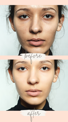 Simple Photo Before and After Skincare Brown Instagram Story.png