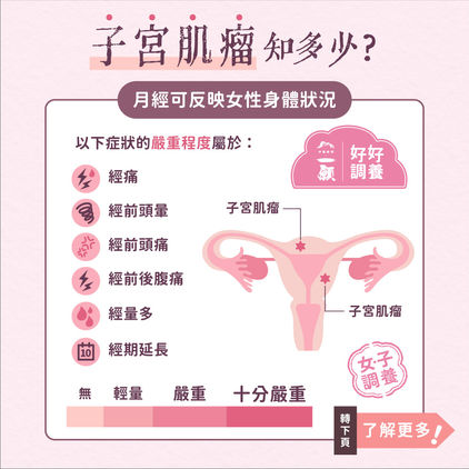 關於子宮肌瘤這回事
