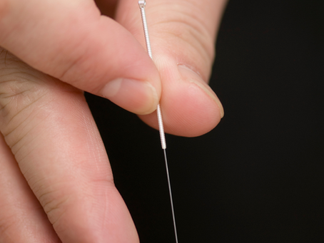 Hand inserting an acupuncture needle into skin against a black background. Close-up showing delicate handling and precise application.