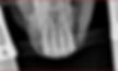 Miniature : Platines X-Ray Solution
