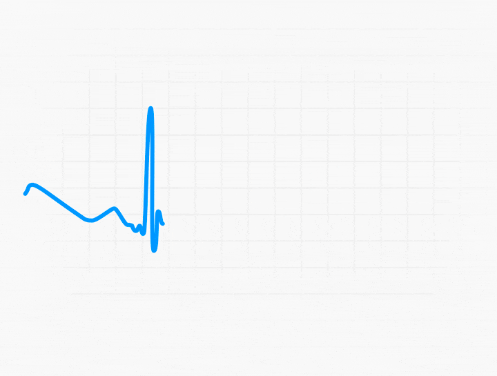 ecg-loading.gif