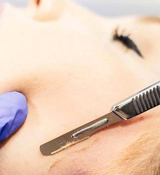 dermaplaning-1kj_edited.jpg