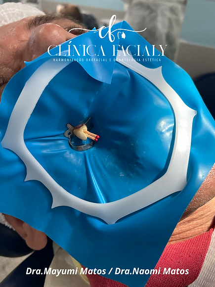 Tratamento de Canal em Santo André