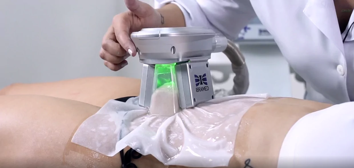 CRIOLIPÓLISE POR REGIÃO