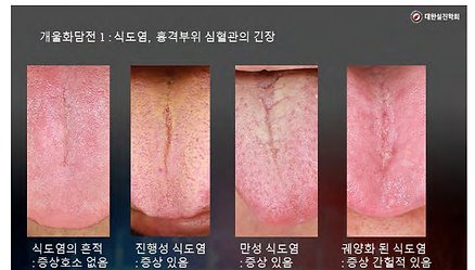 Pattern Tongues Diagnosis | My Site 1