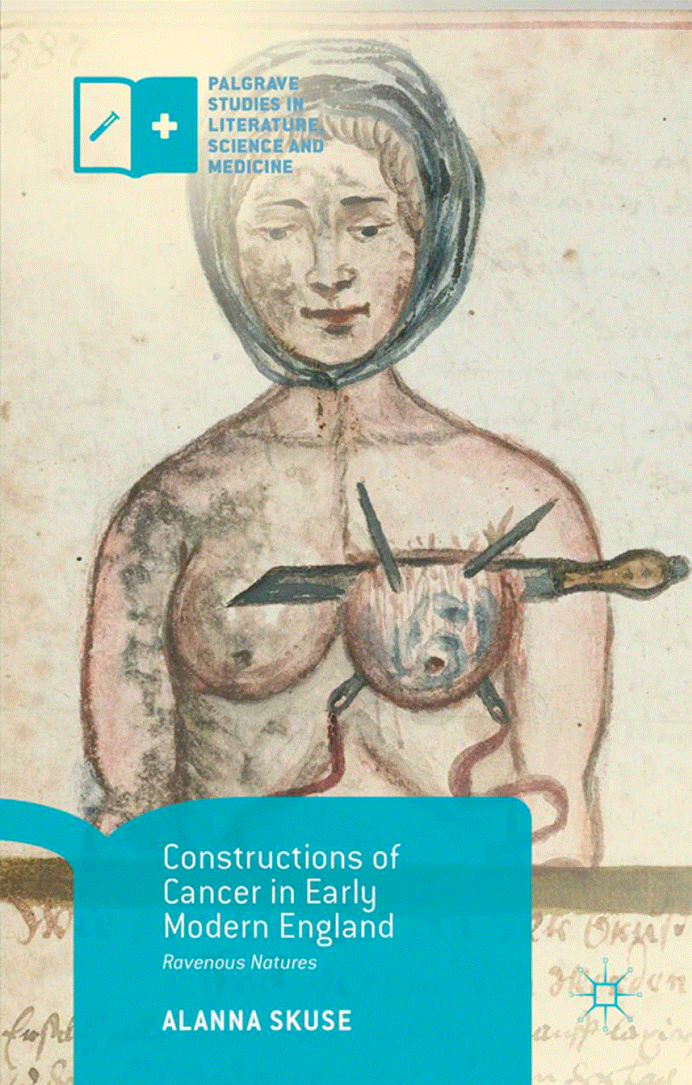Constructions of Cancer in Early Modern England