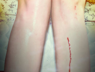 Los Campesinos! – 'Romance Is Boring: 10th Anniversary Reissue' Album Review